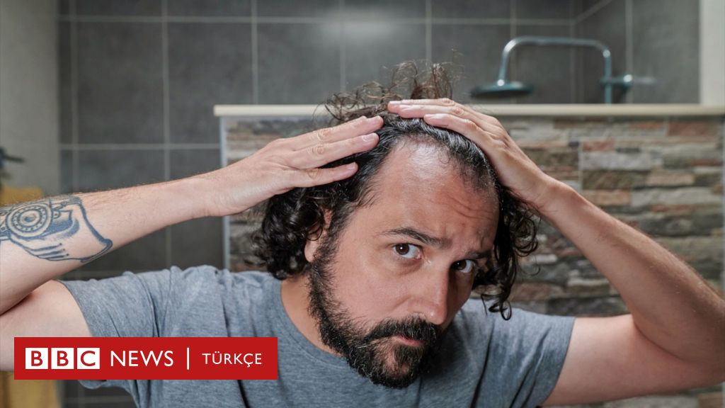 Saç dökülmesi durdurulabilir mi? – BBC News Türkçe Saç dökülmesi durdurulabilir mi? - BBC News Türkçe