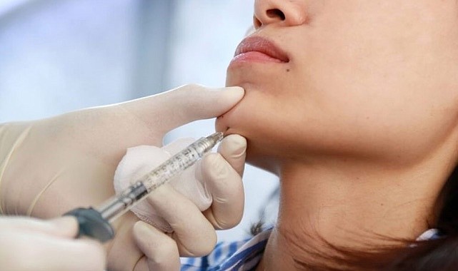 Çene Dolgusu ve Jawline Dolgusu ile Yüz Hatlarında Netlik – Sağlık Çene Dolgusu ve Jawline Dolgusu ile Yüz Hatlarında Netlik - Sağlık